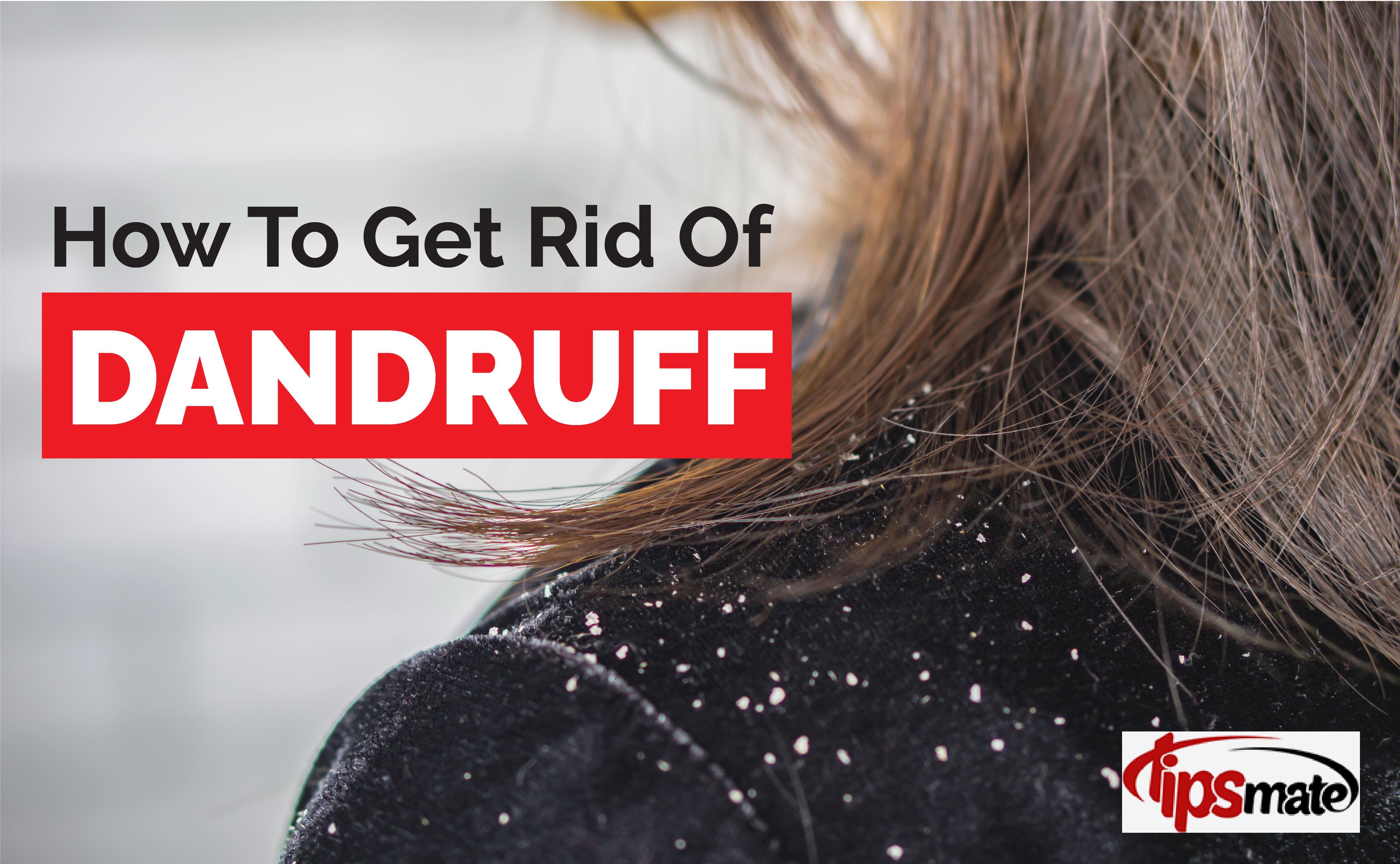 How To Get Rid Of Dandruff
